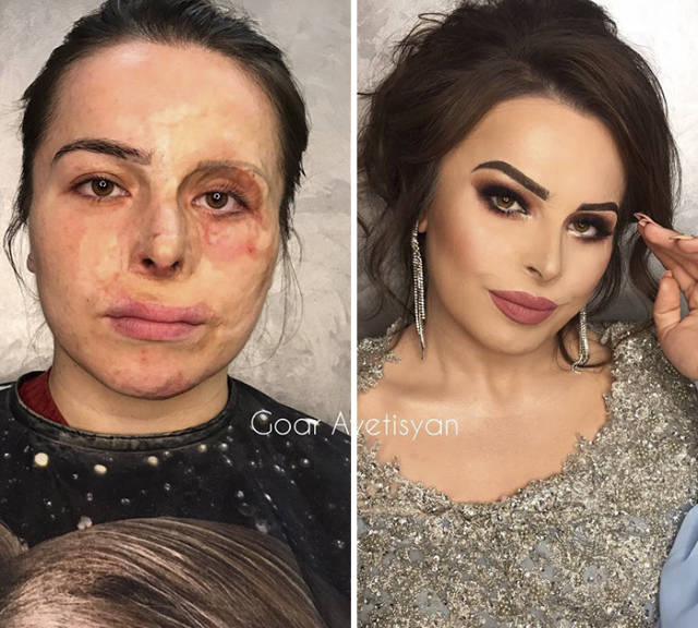 Goar Avetisyan Is A Make Up Fairy For Women With Severe Skin Conditions