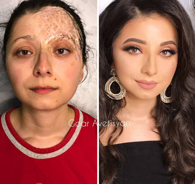 Goar Avetisyan Is A Make Up Fairy For Women With Severe Skin Conditions