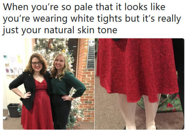 Pale People Know How Painful Life Is