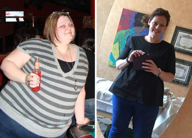 Overweight Woman Lost 40% Of Her Weight After Starting To Follow Her Nutritionist’s Guidance