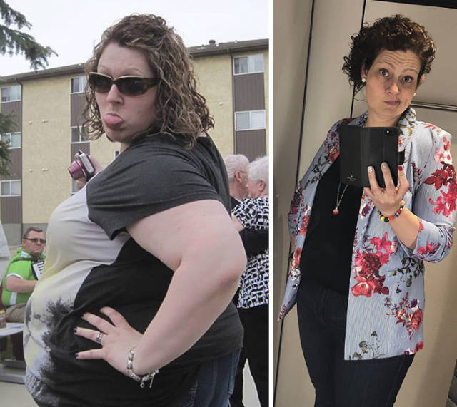 Overweight Woman Lost 40% Of Her Weight After Starting To Follow Her Nutritionist’s Guidance