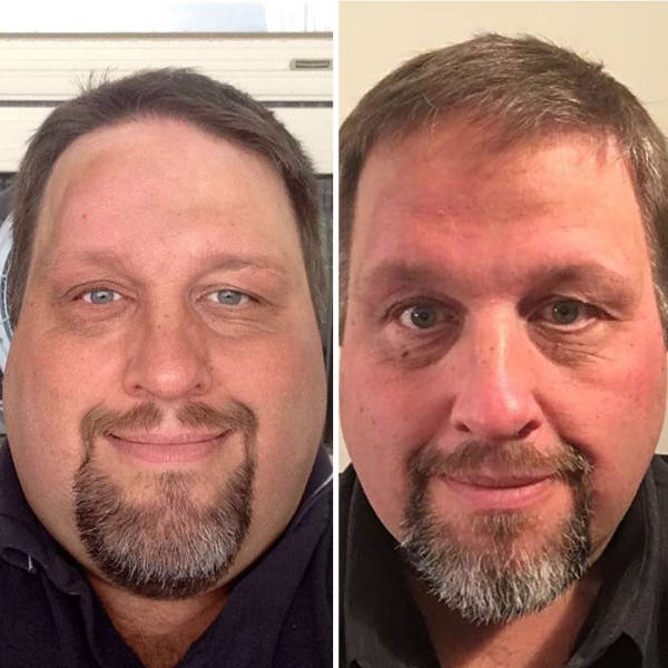 Obese Guy Decided To Change His Life After Seeing That His Excess Weight Might Have Killed Somebody