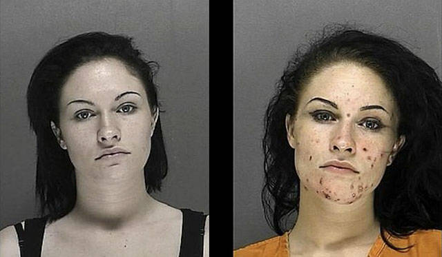 This Is How Meth Changes People