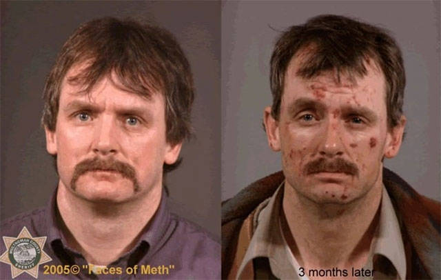 This Is How Meth Changes People
