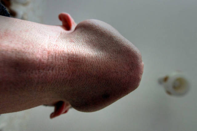 Disturbing Photos Of Bearded Chins From Below Is Something You Didn