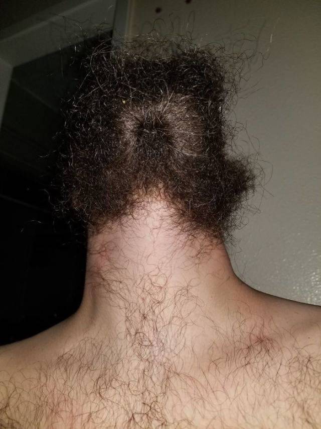 Disturbing Photos Of Bearded Chins From Below Is Something You Didn