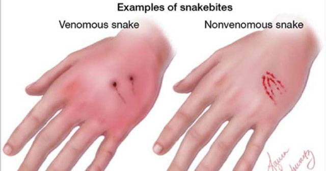 How To Know If A Snake Is Deadly Or Not