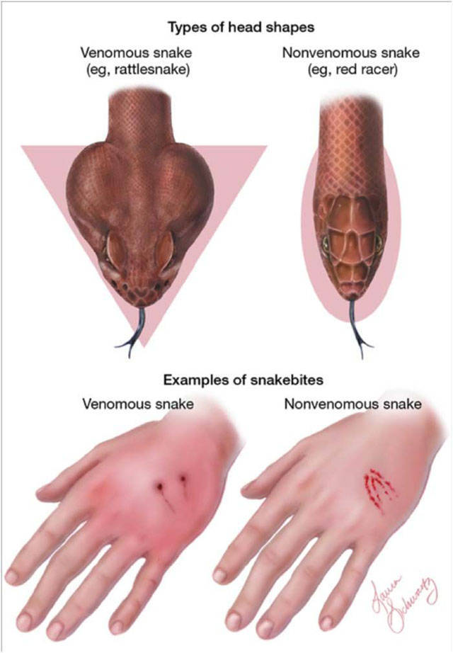 How To Know If A Snake Is Deadly Or Not