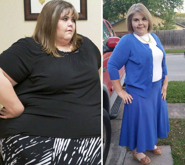 “My 600-lb Life” Participants Show That Nothing Is Impossible If You