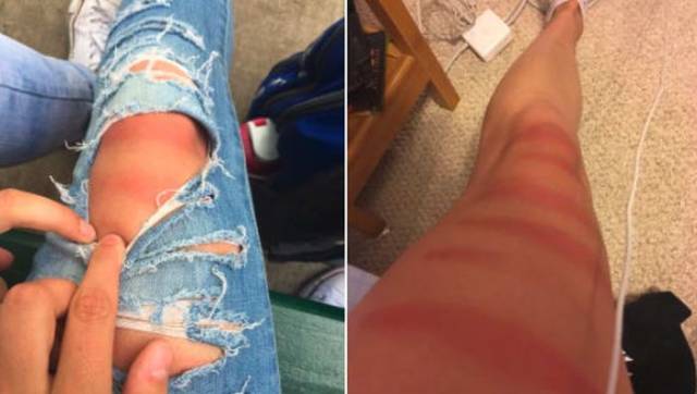 Ripped Jeans And Sun Don’t Go Together