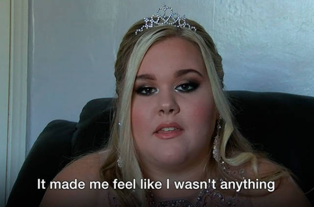 This Girl Was Bullied From Early Age, But Solved That Problem When It Came To Her Prom