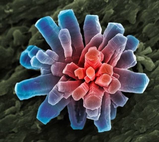 Everything Is Different Under An Electron Microscope