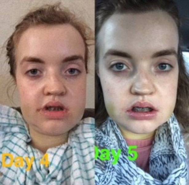 Plastic Surgery Can Change Everything