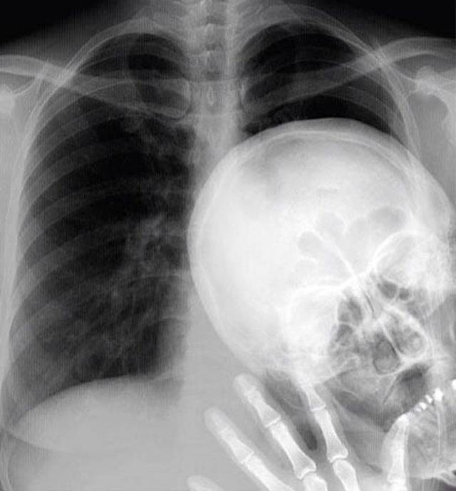 X-Rays Are A Totally Different Perspective