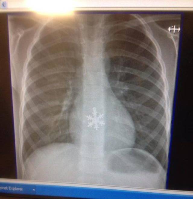 X-Rays Are A Totally Different Perspective