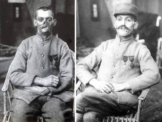 This Woman Gave A Second Chance To So Many Soldiers Whose Faces Were Severely Injured In World War I