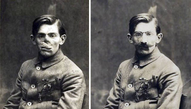 This Woman Gave A Second Chance To So Many Soldiers Whose Faces Were Severely Injured In World War I This Woman Gave A Second Chance To So Many Soldiers Whose Faces Were Severely Injured In World War I