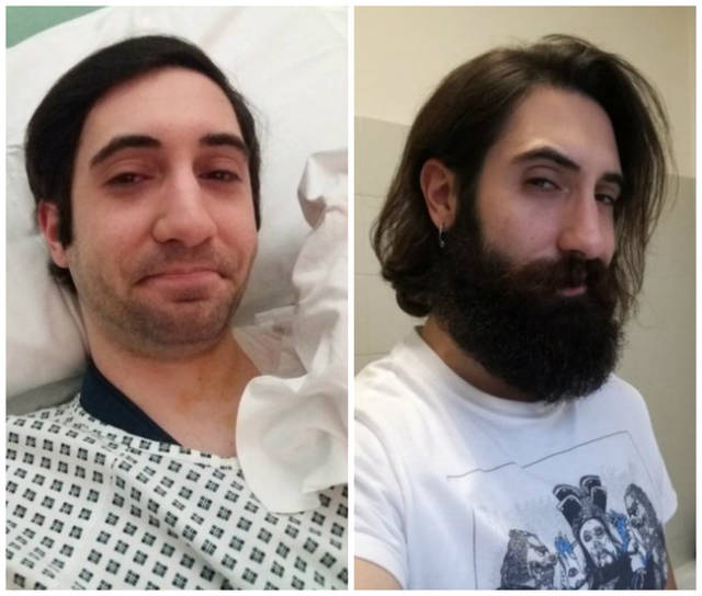 With And Without Beard Photos Are Examples Of Greatest Contrast