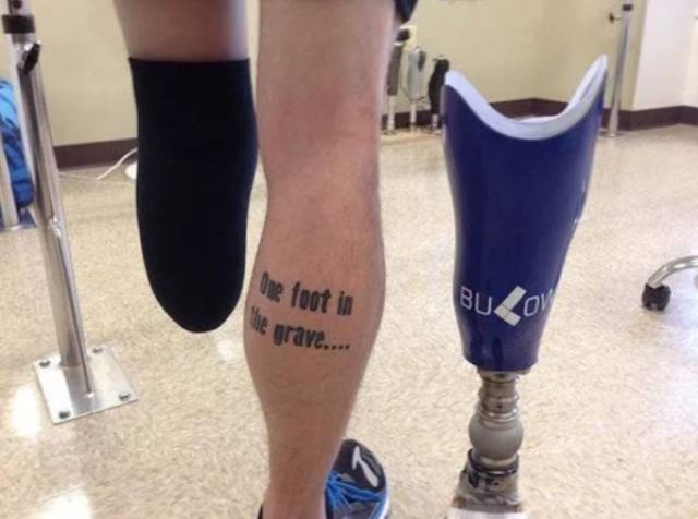 Looks Like Amputation Doesn’t Remove Sense Of Humor