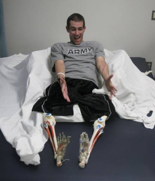 Looks Like Amputation Doesn’t Remove Sense Of Humor