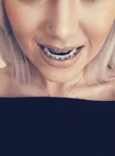 Surgery Didn’t Only Change Her Face – It Changed Her Life