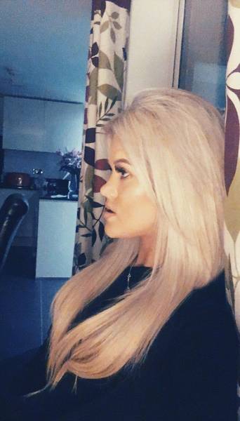 Surgery Didn’t Only Change Her Face – It Changed Her Life