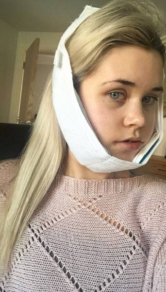 Surgery Didn’t Only Change Her Face – It Changed Her Life