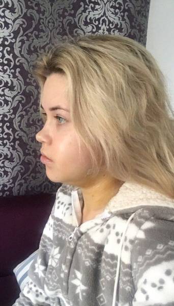 Surgery Didn’t Only Change Her Face – It Changed Her Life