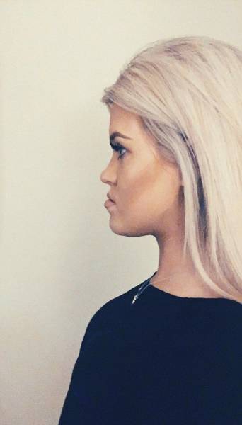 Surgery Didn’t Only Change Her Face – It Changed Her Life