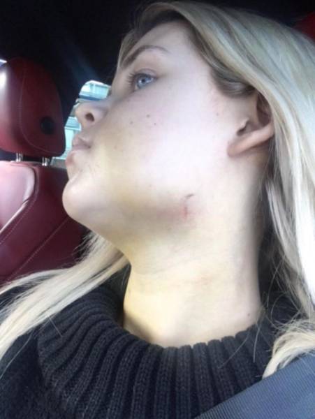 Surgery Didn’t Only Change Her Face – It Changed Her Life