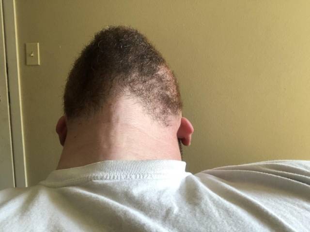 Focus Very Hard And Figure Out What’s Going On Here