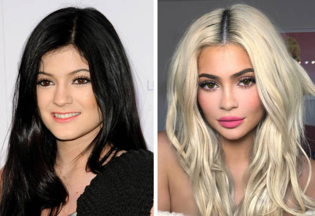 How Celebs Looked Like Before They Turned To Plastic Surgery