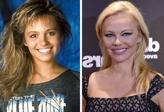 How Celebs Looked Like Before They Turned To Plastic Surgery