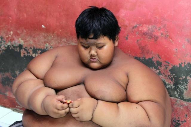 Indonesia’s Fattest Kid Is Now Only A Half Of His Past Self