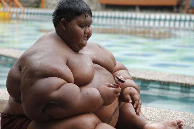 Indonesia’s Fattest Kid Is Now Only A Half Of His Past Self