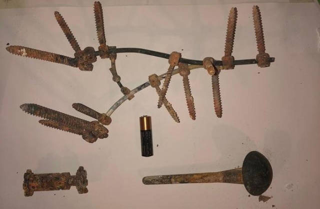 Surgery Hardware Extracted From A Cremated Body