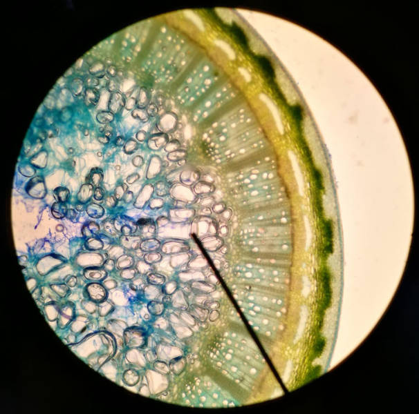 There Is Another World On The Other Side Of The Microscope’s Lenses
