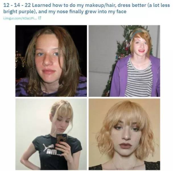 Teenager Transformations Show Just How Awkward Teen Years Are