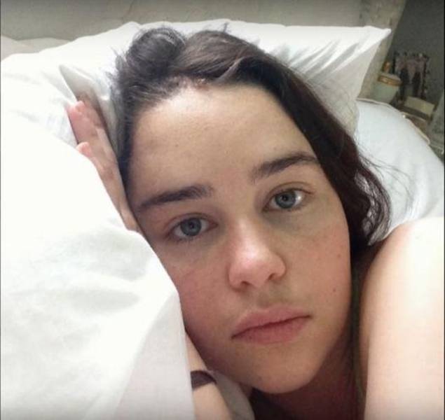 Emilia Clarke After Her Brain Aneurysm Treatment