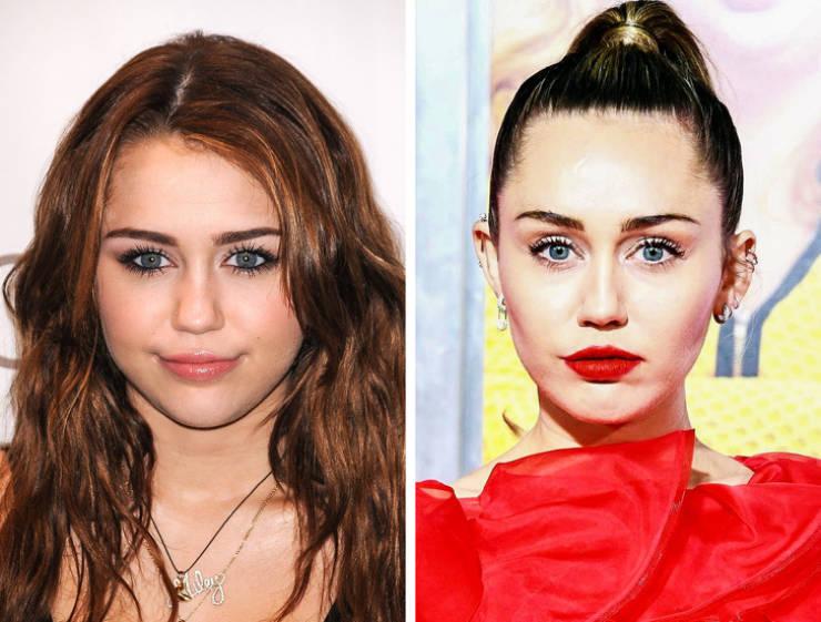 How Celebs Changed Themselves In Their Attempts To Look Better