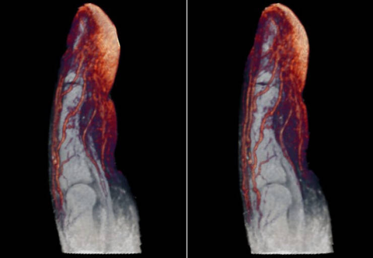 X-Rays Reveal Most Of Our Body’s Secrets