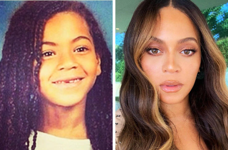 How Celebs Looked In Their School Years Vs. How They Look Now