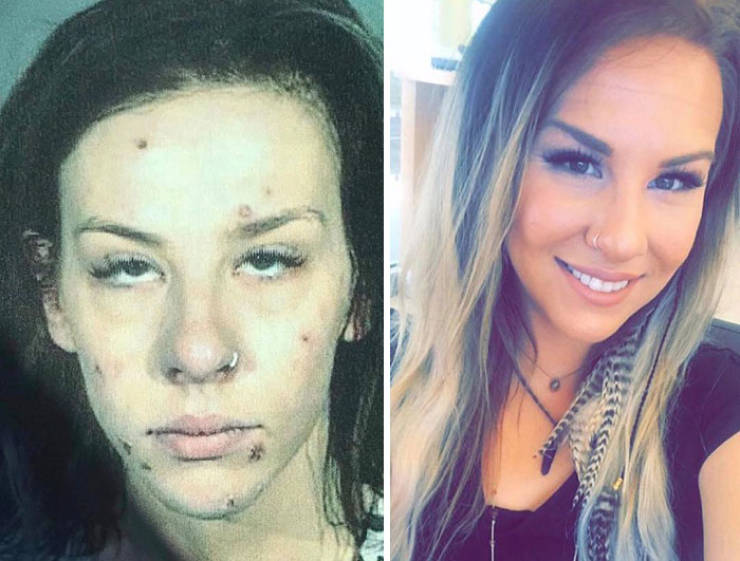 How Drug Addiction Looks Before And After 40 Pics
