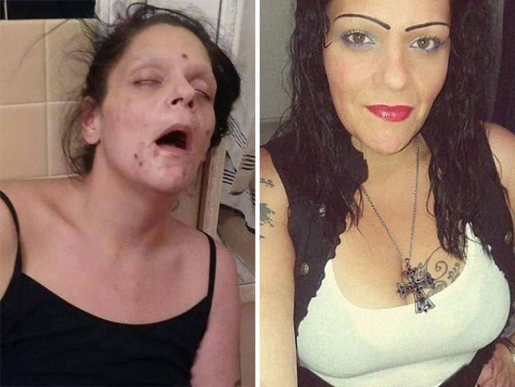How Drug Addiction Looks Before  And After  40 pics 