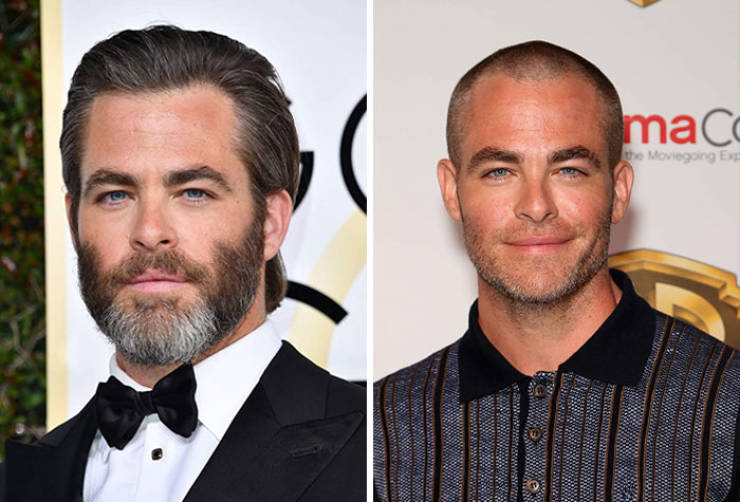 Celebs With And Without Their Hair