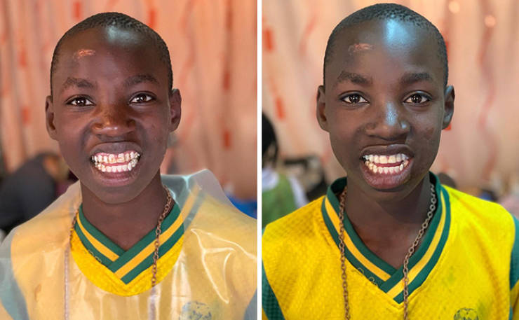 Brazilian Dentist Helps Poor People Transform, And Here Are The Happy Results