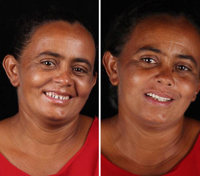 Brazilian Dentist Helps Poor People Transform, And Here Are The Happy Results