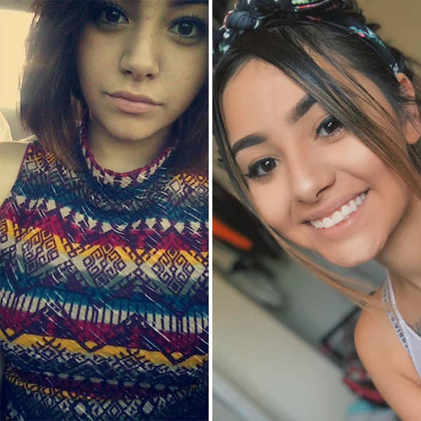 Ex-Addict Starts A Thread Where People Share Their Post-Drug Transformations