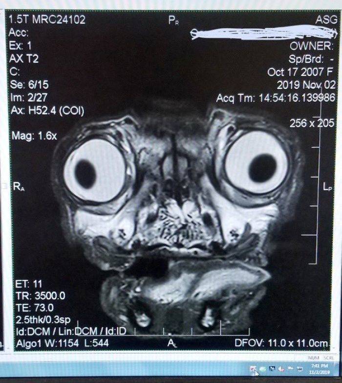 Pug’s MRI Scan Is Not Very Adorable. To Say The Least.