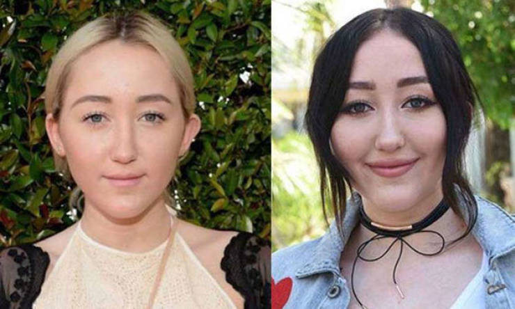 Plastic Surgery Wasn’t Good For Them…